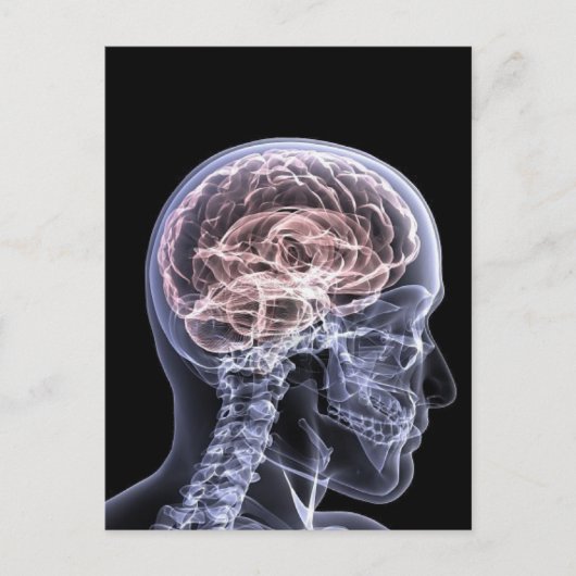 X-Ray Brain Postkarte (Vorderseite)