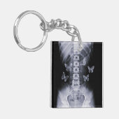 X-Ray Conceptual Butterflies Keychain Schlüsselanhänger (Vorderseite links)