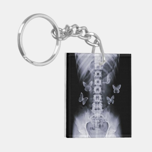 X-Ray Conceptual Butterflies Keychain Schlüsselanhänger (Vorderseite links)