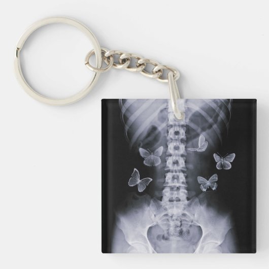 X-Ray Conceptual Butterflies Keychain Schlüsselanhänger (Vorderseite)