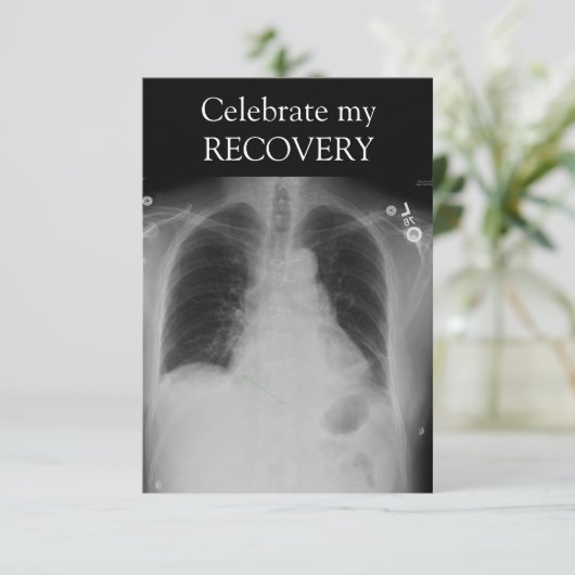 X Ray Erholung ~ Einladung (Stehend Vorderseite)