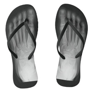 X-Ray Feet! Badesandalen