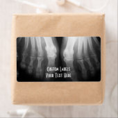 X-Ray füttert menschliche Skelettknochen schwarz & (Insitu)