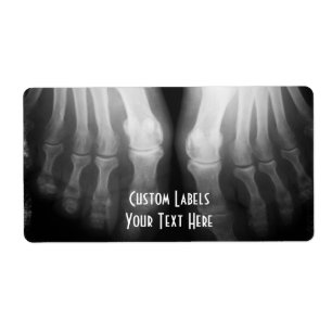 X-Ray füttert menschliche Skelettknochen schwarz &