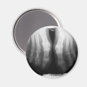 X-Ray füttert menschliche Skelettknochen schwarz & Magnet (Vorderseite/Rückseite)