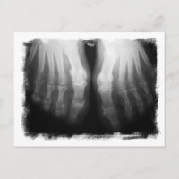 X-Ray füttert menschliche Skelettknochen schwarz &