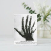 X-Ray Hand mit Extra Finger Postkarte (Stehend Vorderseite)