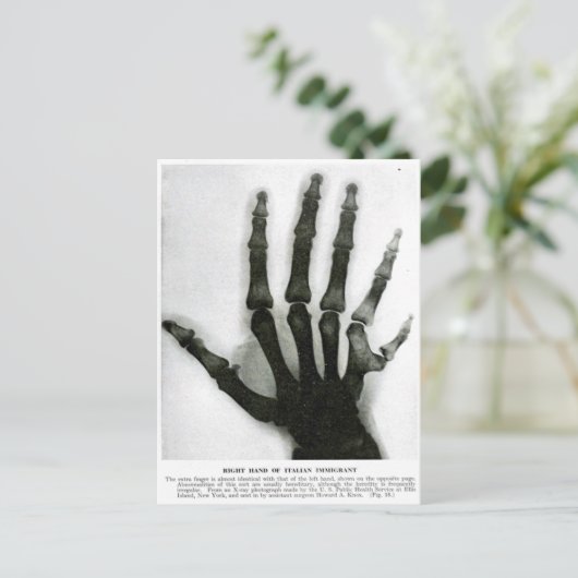 X-Ray Hand mit Extra Finger Postkarte (Stehend Vorderseite)