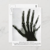 X-Ray Hand mit Extra Finger Postkarte (Vorne/Hinten)