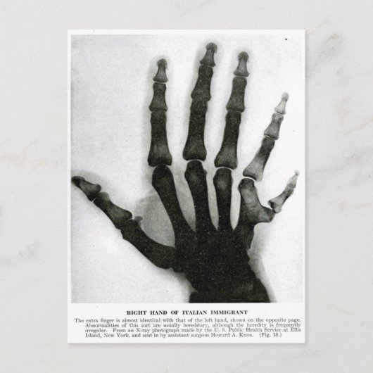 X-Ray Hand mit Extra Finger Postkarte (Vorderseite)