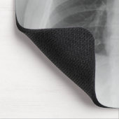 X-Ray Mousepad (Ecke)
