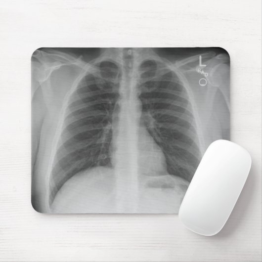X-Ray Mousepad (Mit Mouse)