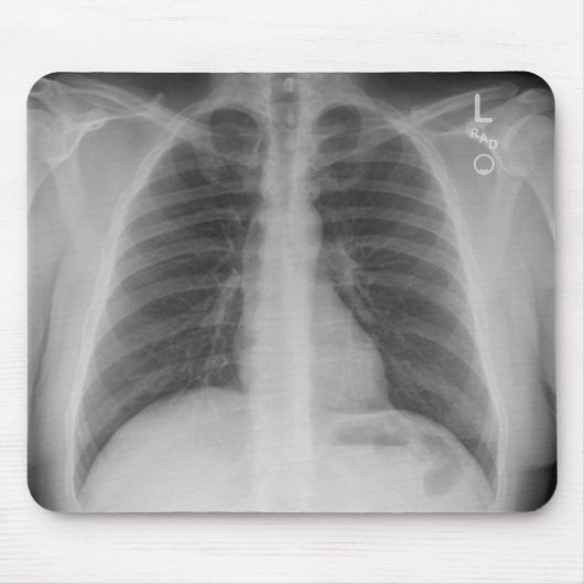 X-Ray Mousepad (Vorne)