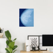 X-ray of female breast, side view poster (Heimbüro)
