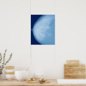 X-ray of female breast, side view poster (Küche)