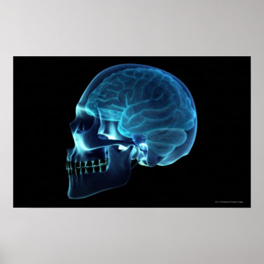 X-ray of the brain inside a skull poster (Vorne)