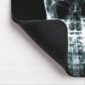 X-RAY SKELETON BRIGHT IDEE - ORIGINAL MOUSEPAD (Ecke)