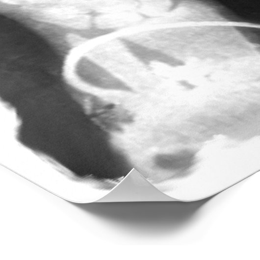 X-Ray Skeleton Hands & Schmuck - B&W Poster (Ecke)