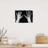 X-Ray Skeleton Hands & Schmuck - B&W Poster (Küche)