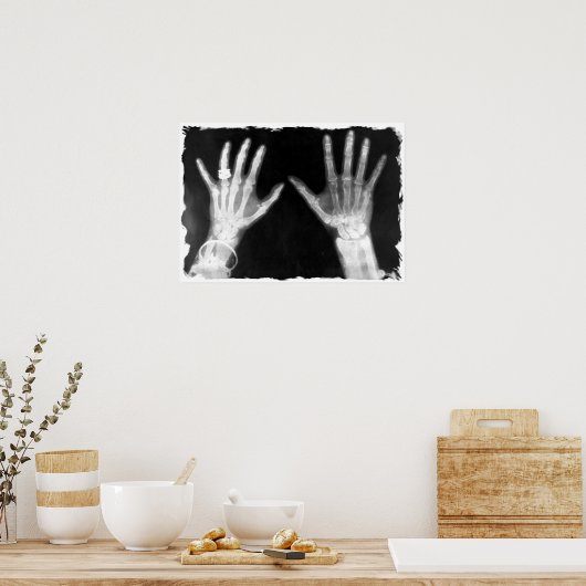 X-Ray Skeleton Hands & Schmuck - B&W Poster (Küche)