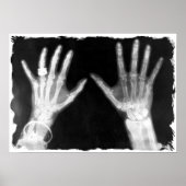 X-Ray Skeleton Hands & Schmuck - B&W Poster (Vorne)