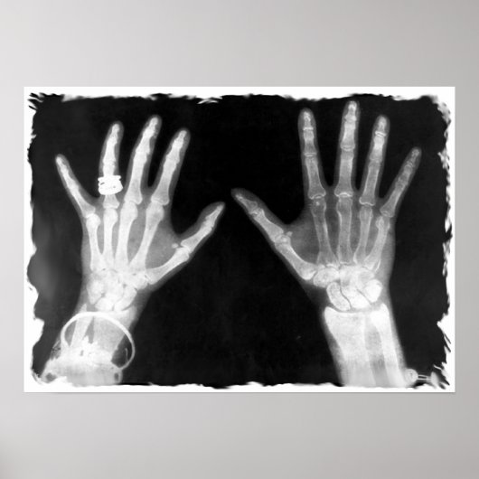 X-Ray Skeleton Hands & Schmuck - B&W Poster (Vorne)