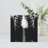 X-RAY SKELETON TORSO RIBS - B&W EINLADUNG (Stehend Vorderseite)