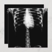 X-RAY SKELETON TORSO RIBS - B&W EINLADUNG (Vorne/Hinten)