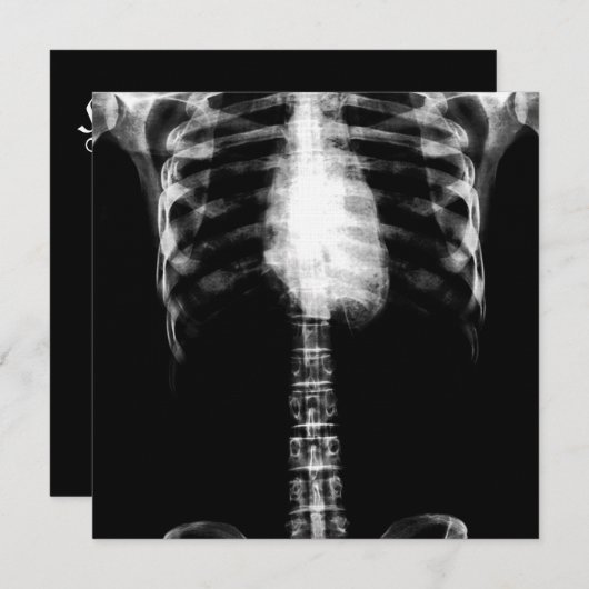 X-RAY SKELETON TORSO RIBS - B&W EINLADUNG (Vorne/Hinten)