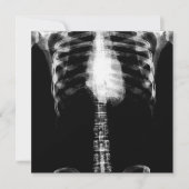 X-RAY SKELETON TORSO RIBS - B&W EINLADUNG (Vorderseite)
