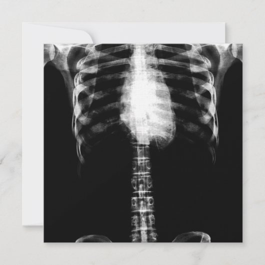 X-RAY SKELETON TORSO RIBS - B&W EINLADUNG (Vorderseite)