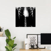 X-RAY SKELETON TORSO RIBS - B&W POSTER (Heimbüro)