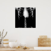 X-RAY SKELETON TORSO RIBS - B&W POSTER (Küche)
