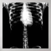 X-RAY SKELETON TORSO RIBS - B&W POSTER (Vorne)