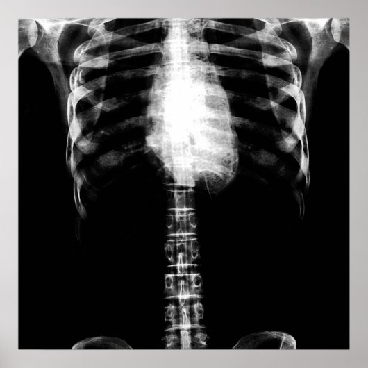 X-RAY SKELETON TORSO RIBS - B&W POSTER (Vorne)