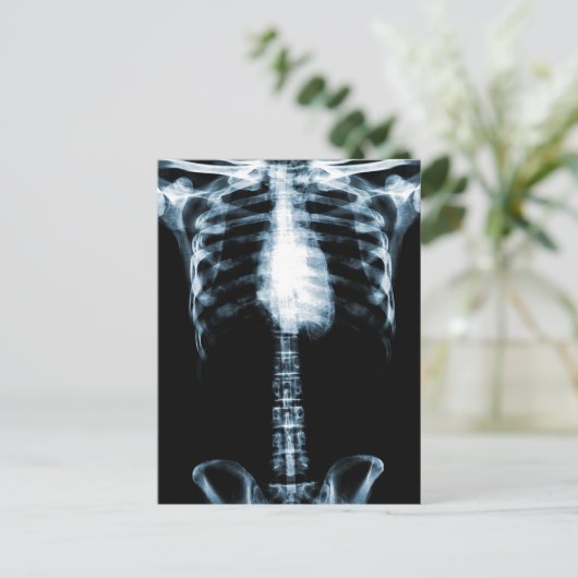 X-RAY SKELETON TORSO RIBS BLAUE POSTKARTE (Stehend Vorderseite)