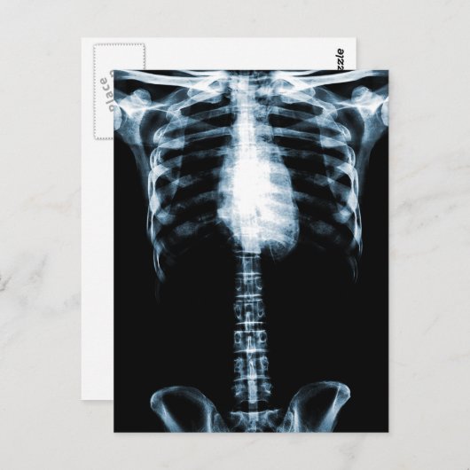 X-RAY SKELETON TORSO RIBS BLAUE POSTKARTE (Vorne/Hinten)