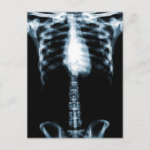 X-RAY SKELETON TORSO RIBS BLAUE POSTKARTE (Vorderseite)