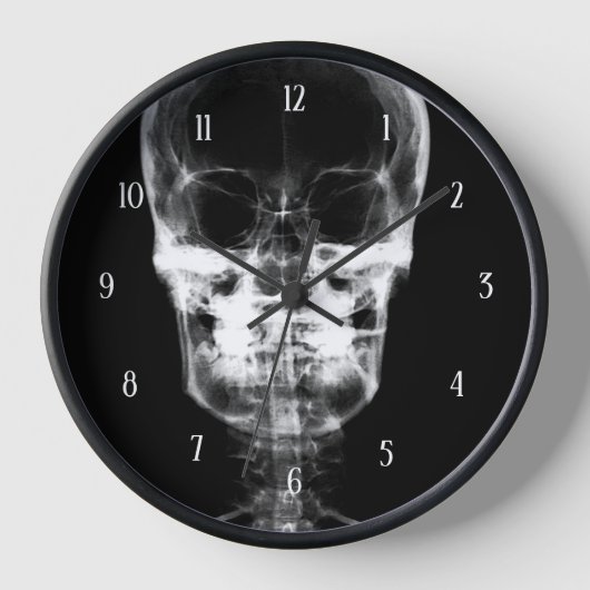 X-Ray Skull - B&W Uhr (Vorderseite)