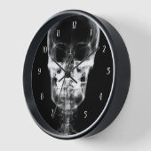 X-Ray Skull - B&W Uhr (Winkel)