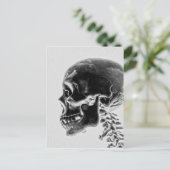 X-Ray Skull Postkarte (Stehend Vorderseite)