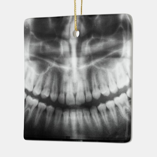 X-Ray Teeth Mouth Smile Schwarz-Weiß Keramikornament (Links)
