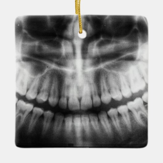 X-Ray Teeth Mouth Smile Schwarz-Weiß Keramikornament (Vorderseite)