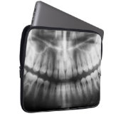 X-Ray Teeth Mouth Smile Schwarz-Weiß Laptopschutzhülle (Vorne Rechts)