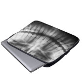 X-Ray Teeth Mouth Smile Schwarz-Weiß Laptopschutzhülle (Vorne Knopf)