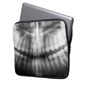 X-Ray Teeth Mouth Smile Schwarz-Weiß Laptopschutzhülle (Vorderseite Links)