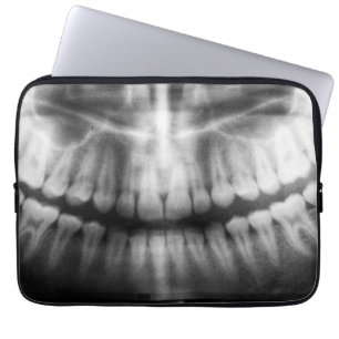 X-Ray Teeth Mouth Smile Schwarz-Weiß Laptopschutzhülle