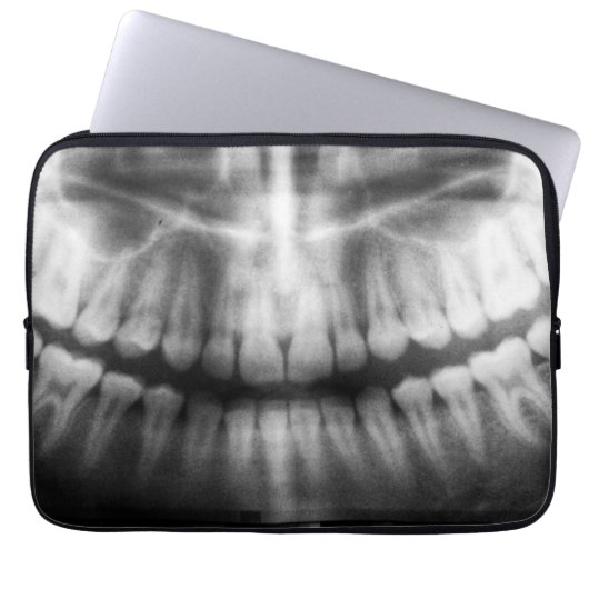 X-Ray Teeth Mouth Smile Schwarz-Weiß Laptopschutzhülle (Vorderseite)