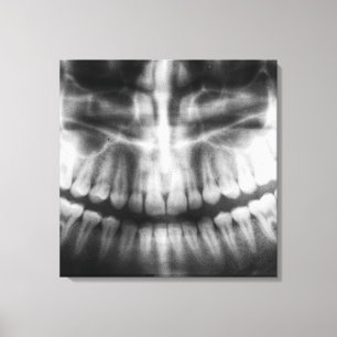 X-Ray Teeth Mouth Smile Schwarz-Weiß Leinwanddruck