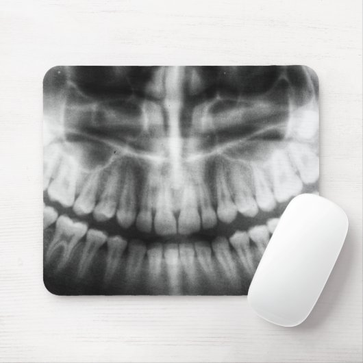 X-Ray Teeth Mouth Smile Schwarz-Weiß Mousepad (Mit Mouse)
